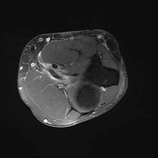 Click on the Serie image to view the images of Wieszt, Gnter